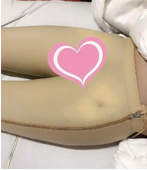 这是我术前的检查